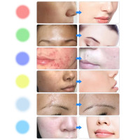 Светодиодный аппарат для лица inSPORTline Coladome 900