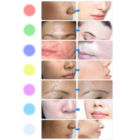 Светодиодная маска для лица inSPORTline Esgrima