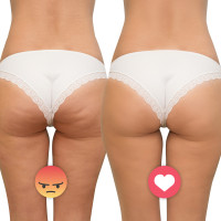 Антицеллюлитный ультразвуковой массажер inSPORTline Valeri