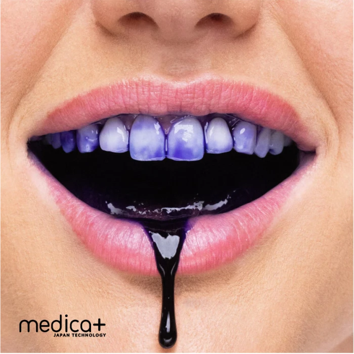 Отбеливающий корректор для цвета зубов MEDICA+ V34