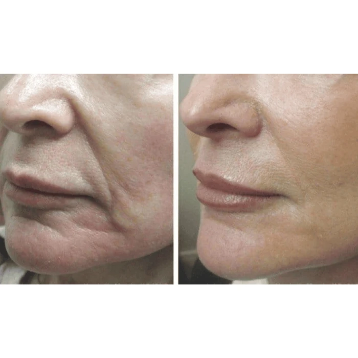 Мікрострумовий ліфтинг-масажер MEDICA+ Skin Lifting 5.0 (Japan)