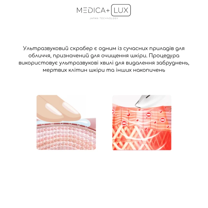 Ультразвуковой скраббер MEDICA+ Lux SuperSonic 10