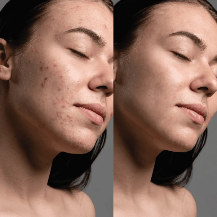 LED-маска FANTOM для светотерапии MEDICA+ (Japan)