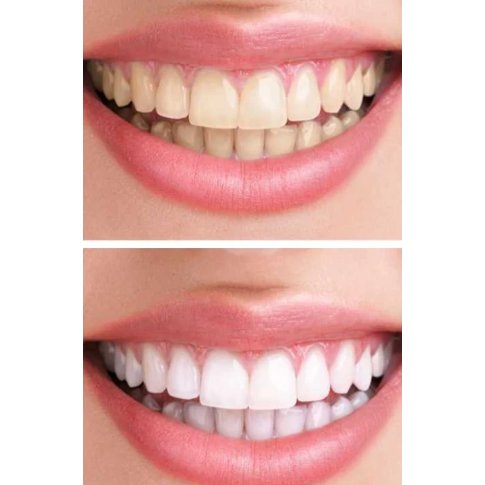 Набір звукових зубних щіток MEDICA+ PROBRUSH 7.0 black + silver (Japan)