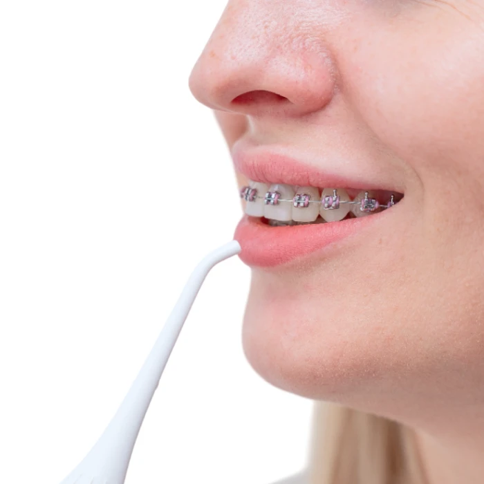 Портативний іригатор MEDICA+ Lux Prowater 10 Gold Soft Touch (Japan)