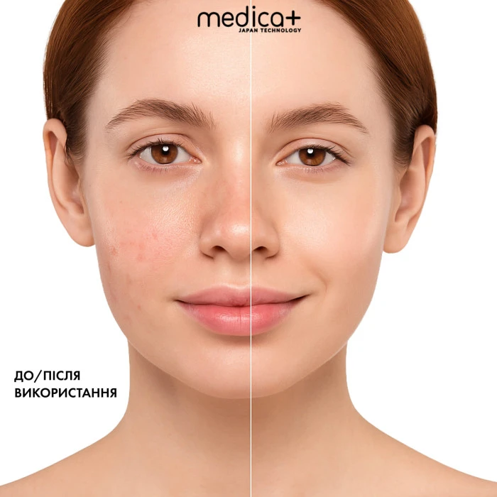 LED-маска для светотерапии MEDICA+ LEDMask 8X (Japan)