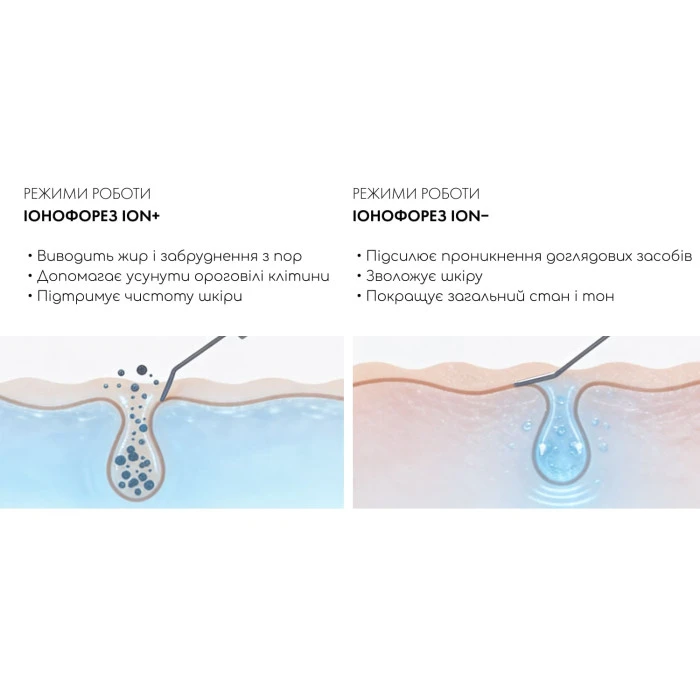 Ультразвуковий скрабер Vibroskin 12 PRO (Japan)