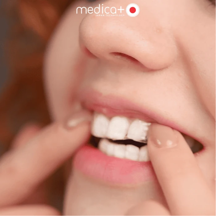 Отбеливающие полоски MEDICA+ 3DWhite Strips