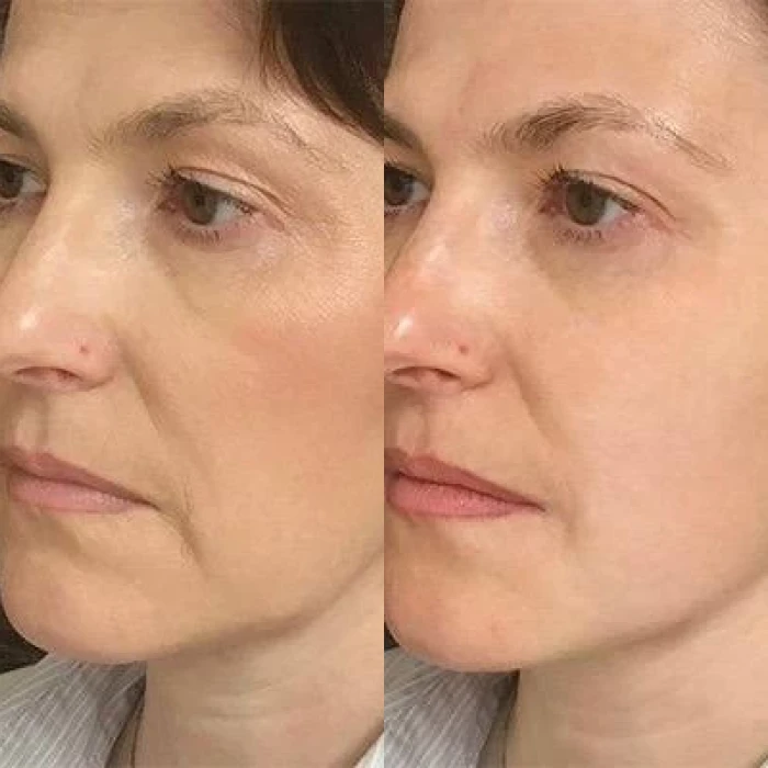 Разуживающая маска для лица MEDICA+ Pore Control Mask (50 мл)