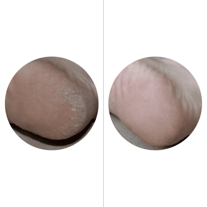 MonnaLi Интенсивный крем для пяток от трещин и сухости