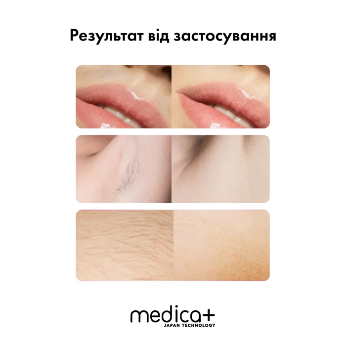 Фотоэпилятор Medica+ Haircleaner 5.0 IPL