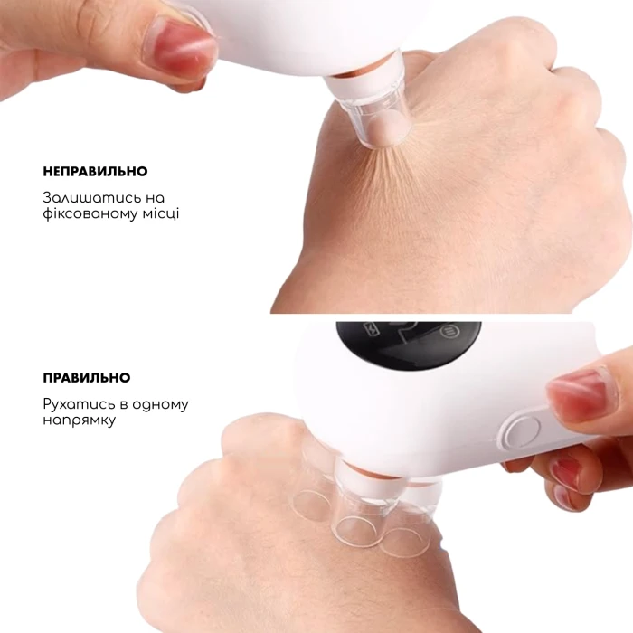 Набор Вакуумного Очистителя для кожи и пор Medica+ Scinclean 7.0