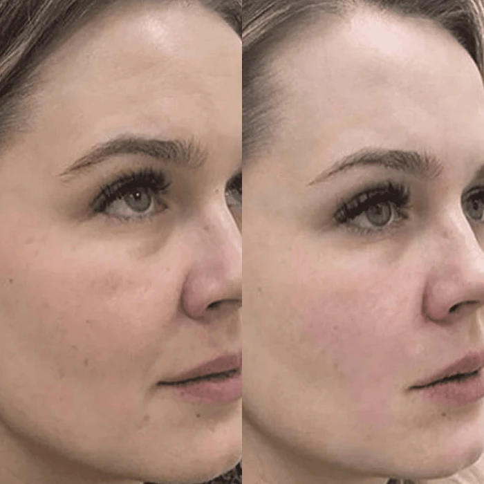 Гидратирующий гель MEDICA+ Hydration Gel (100 мл)