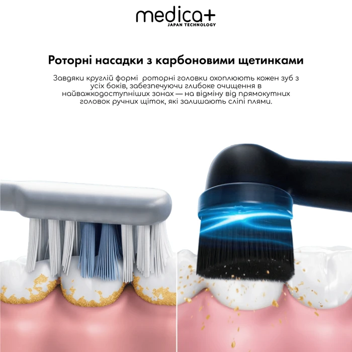 Электрическая зубная щетка MEDICA+ ProBrush XO Сарбон Soft Touch (Black) (Japan)