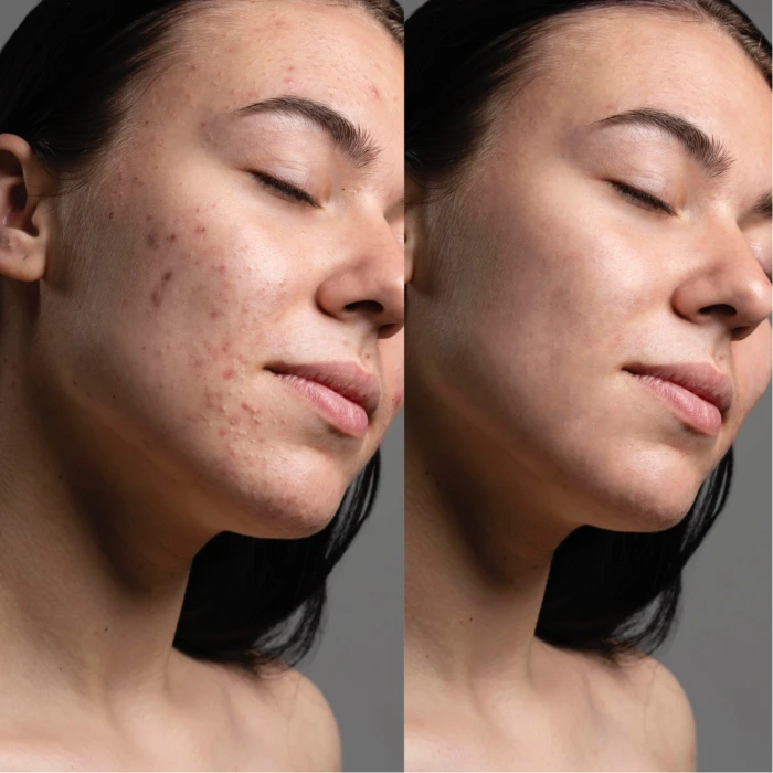 LED-маска для микротоковой и светотерапии Medica+ LEDMask 7X