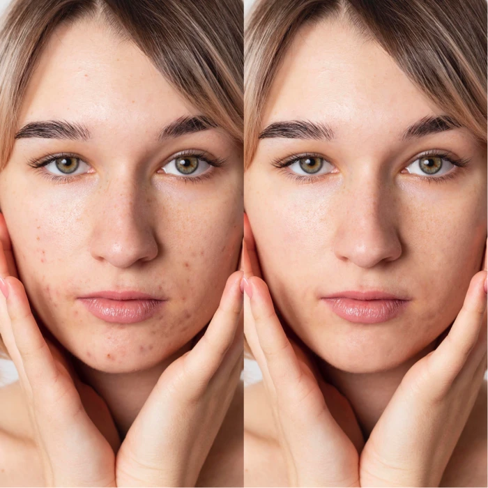 LED-маска для микротоковой и светотерапии Medica+ LEDMask 7X