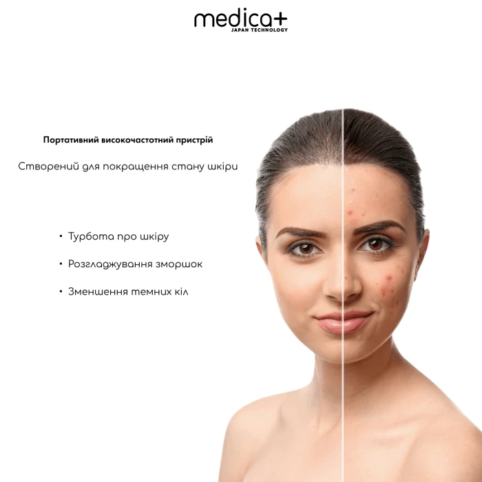 Набор Вакуумного очистителя для кожи и пор Medica+ Scinclean 9.0 WT