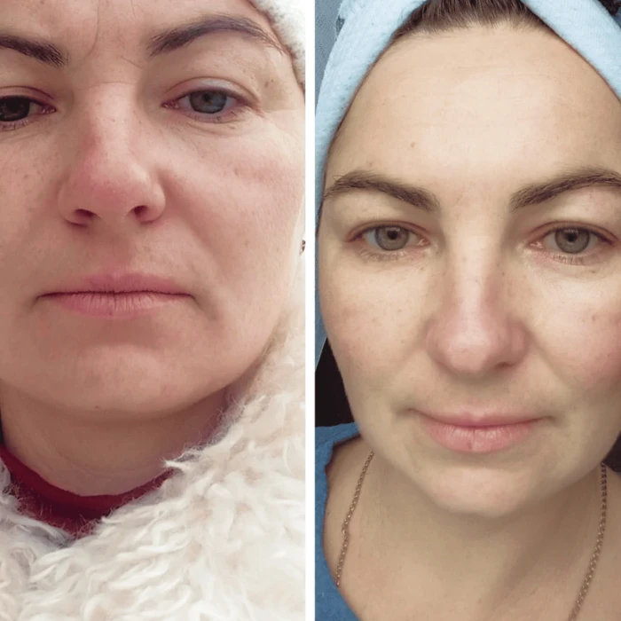 Успокаивающая маска для лица MEDICA+ Soothing Mask (50 мл)